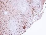 POLH Antibody in Immunohistochemistry (Paraffin) (IHC (P))