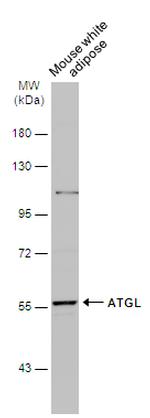 ATGL Antibody in Western Blot (WB)