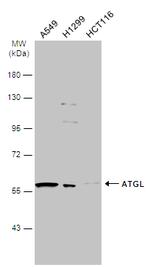 ATGL Antibody in Western Blot (WB)