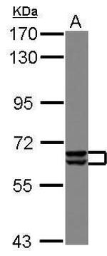 PAK3 Antibody in Western Blot (WB)