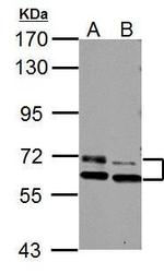 PAK3 Antibody in Western Blot (WB)