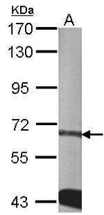 CDKAL1 Antibody in Western Blot (WB)