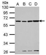 GC Antibody in Western Blot (WB)