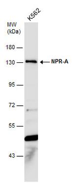 NPR1 Antibody in Western Blot (WB)