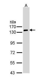 NPR1 Antibody in Western Blot (WB)