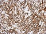 PKC theta Antibody in Immunohistochemistry (Paraffin) (IHC (P))