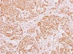 ALDH5A1 Antibody in Immunohistochemistry (Paraffin) (IHC (P))