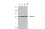 PLA2G4A Antibody in Western Blot (WB)