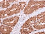 HDAC4 Antibody in Immunohistochemistry (Paraffin) (IHC (P))