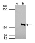 HDAC4 Antibody in Immunoprecipitation (IP)