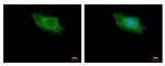 IKAP Antibody in Immunocytochemistry (ICC/IF)