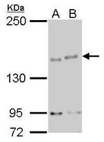 IKAP Antibody in Western Blot (WB)