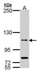 PDE11A Antibody in Western Blot (WB)