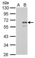 Factor X/Xa Antibody in Western Blot (WB)