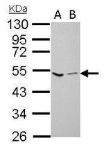 Factor X/Xa Antibody in Western Blot (WB)