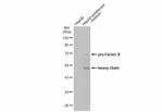 Factor X/Xa Antibody in Western Blot (WB)