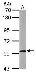 CABC1 Antibody in Western Blot (WB)