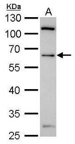 YY1 Antibody in Western Blot (WB)