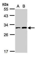 TIGAR Antibody in Western Blot (WB)