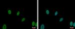 ERCC1 Antibody in Immunocytochemistry (ICC/IF)