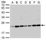 BID Antibody in Western Blot (WB)