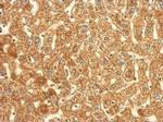 TrxR1 Antibody in Immunohistochemistry (Paraffin) (IHC (P))