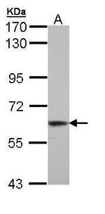 TrxR1 Antibody in Western Blot (WB)