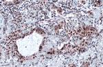 SP1 Antibody in Immunohistochemistry (Paraffin) (IHC (P))