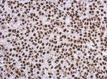 SP1 Antibody in Immunohistochemistry (Paraffin) (IHC (P))