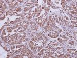 AKT1 Antibody in Immunohistochemistry (Paraffin) (IHC (P))