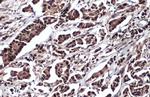 DDX3 Antibody in Immunohistochemistry (Paraffin) (IHC (P))