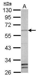 YY1 Antibody in Western Blot (WB)