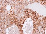 RBP4 Antibody in Immunohistochemistry (Paraffin) (IHC (P))