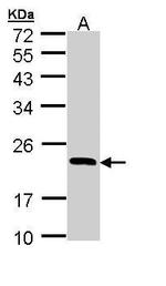 RBP4 Antibody in Western Blot (WB)