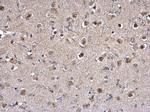 PPT1 Antibody in Immunohistochemistry (Paraffin) (IHC (P))