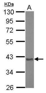 Aspartoacylase Antibody in Western Blot (WB)