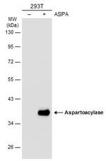 Aspartoacylase Antibody in Western Blot (WB)