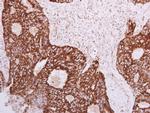 SLC25A22 Antibody in Immunohistochemistry (Paraffin) (IHC (P))