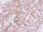 SLC25A22 Antibody in Immunohistochemistry (Paraffin) (IHC (P))