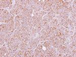 HTRA2 Antibody in Immunohistochemistry (Paraffin) (IHC (P))