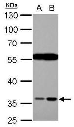 HTRA2 Antibody in Western Blot (WB)