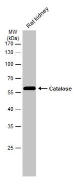 Catalase Antibody in Western Blot (WB)