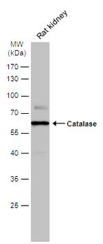 Catalase Antibody in Western Blot (WB)