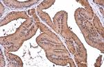 ALDH1A3 Antibody in Immunohistochemistry (Paraffin) (IHC (P))