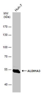 ALDH1A3 Antibody in Western Blot (WB)