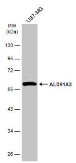 ALDH1A3 Antibody in Western Blot (WB)