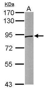 Sortilin Antibody in Western Blot (WB)