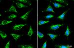 SLC25A6 Antibody in Immunocytochemistry (ICC/IF)