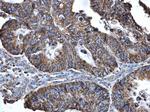 SLC25A6 Antibody in Immunohistochemistry (Paraffin) (IHC (P))