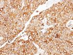 CIDEC Antibody in Immunohistochemistry (Paraffin) (IHC (P))